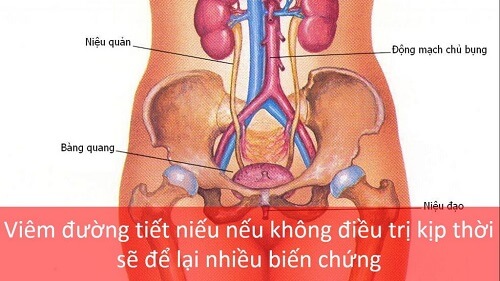 Viêm đường tiết niệu nam giới có gặp nguy hiểm không?